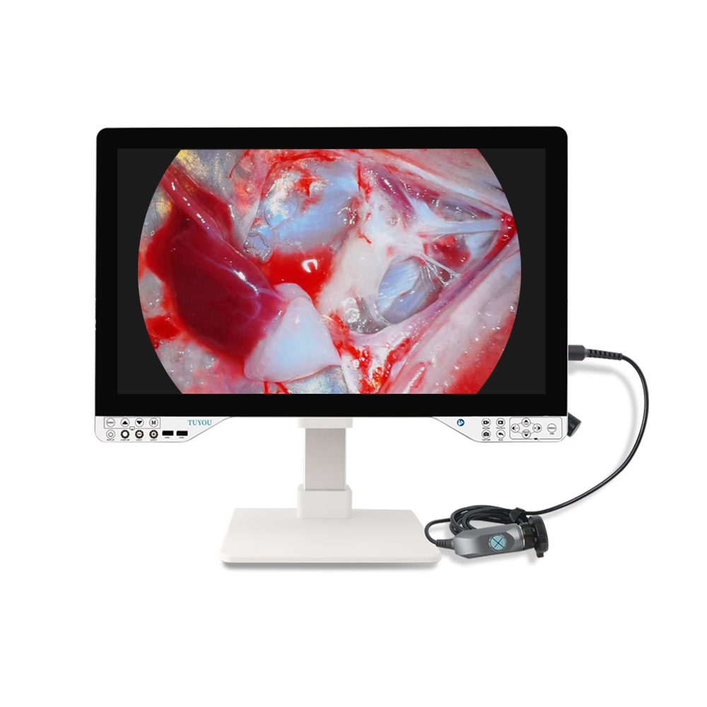 Equine endoscope imaging system