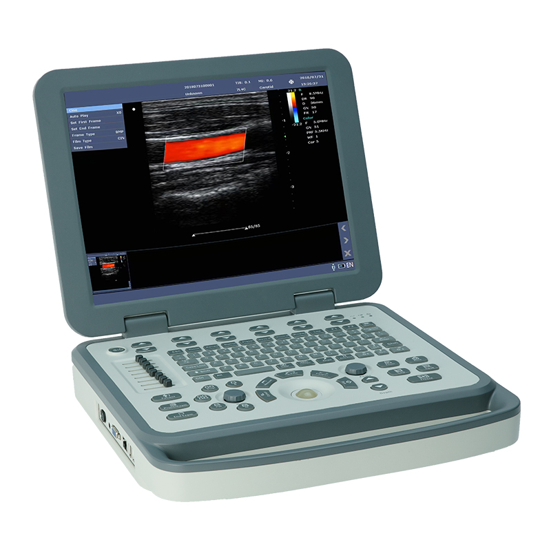 MS-M5 Portable Veterinary Ultrasound Machine view 2