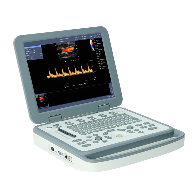 MS-M5 Portable Veterinary Ultrasound Machine view 3