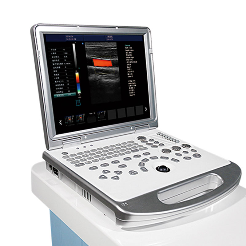 MS-M9 4D Veterinary Ultrasound Machine view 4